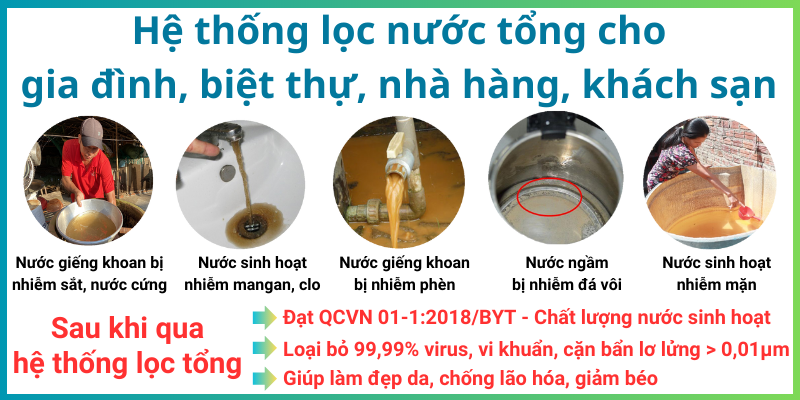 Máy lọc nước cho cả nhà - Đừng Để Nước Làm Hại Đến Sức Khỏe Gia Đình Của Bạn